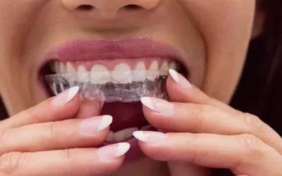 Invisalign Santa Ana: Clear Aligner Therapy for Discreet Orthodontic Correction